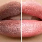 10 Cara Mengatasi Bibir Hitam Secara Alami dan Aman