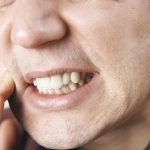 10 Penyebab Umum Nyeri Rahang dan Cara Menghindarinya