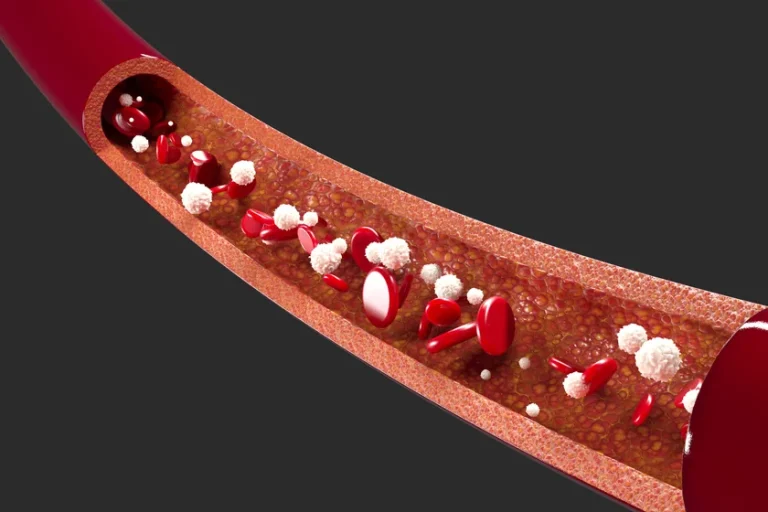 10 Kebiasaan Sehari-hari untuk Peredaran Darah yang Optimal