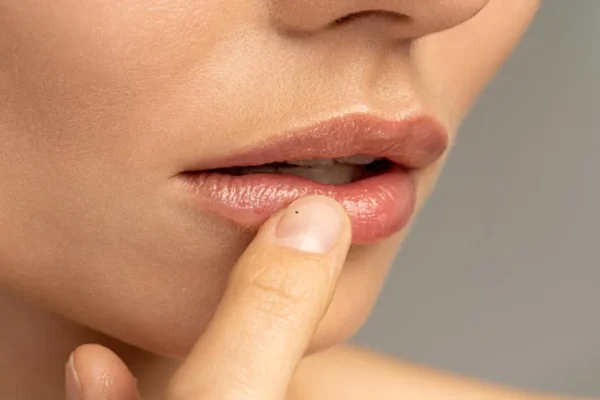 7 Cara Mengatasi Bibir Hitam Secara Alami