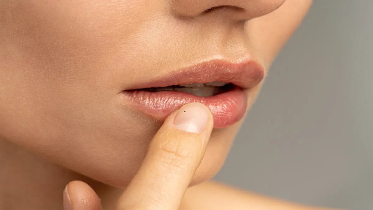 7 Cara Mengatasi Bibir Hitam Secara Alami