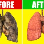 10 Cara Menghindari Polusi agar Paru-Paru Gak Kotor
