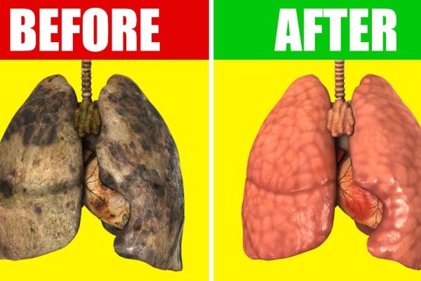 10 Cara Menghindari Polusi agar Paru-Paru Gak Kotor